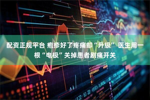 配资正规平台 疱疹好了疼痛却“升级” 医生用一根“电极”关掉患者剧痛开关